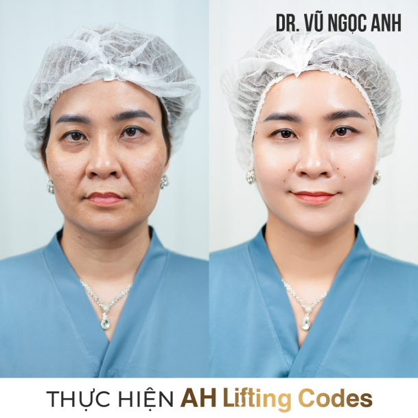 Dịch vụ 12 khách hàng sau khi thực hiện liệu trình AH Lifting Codes 2