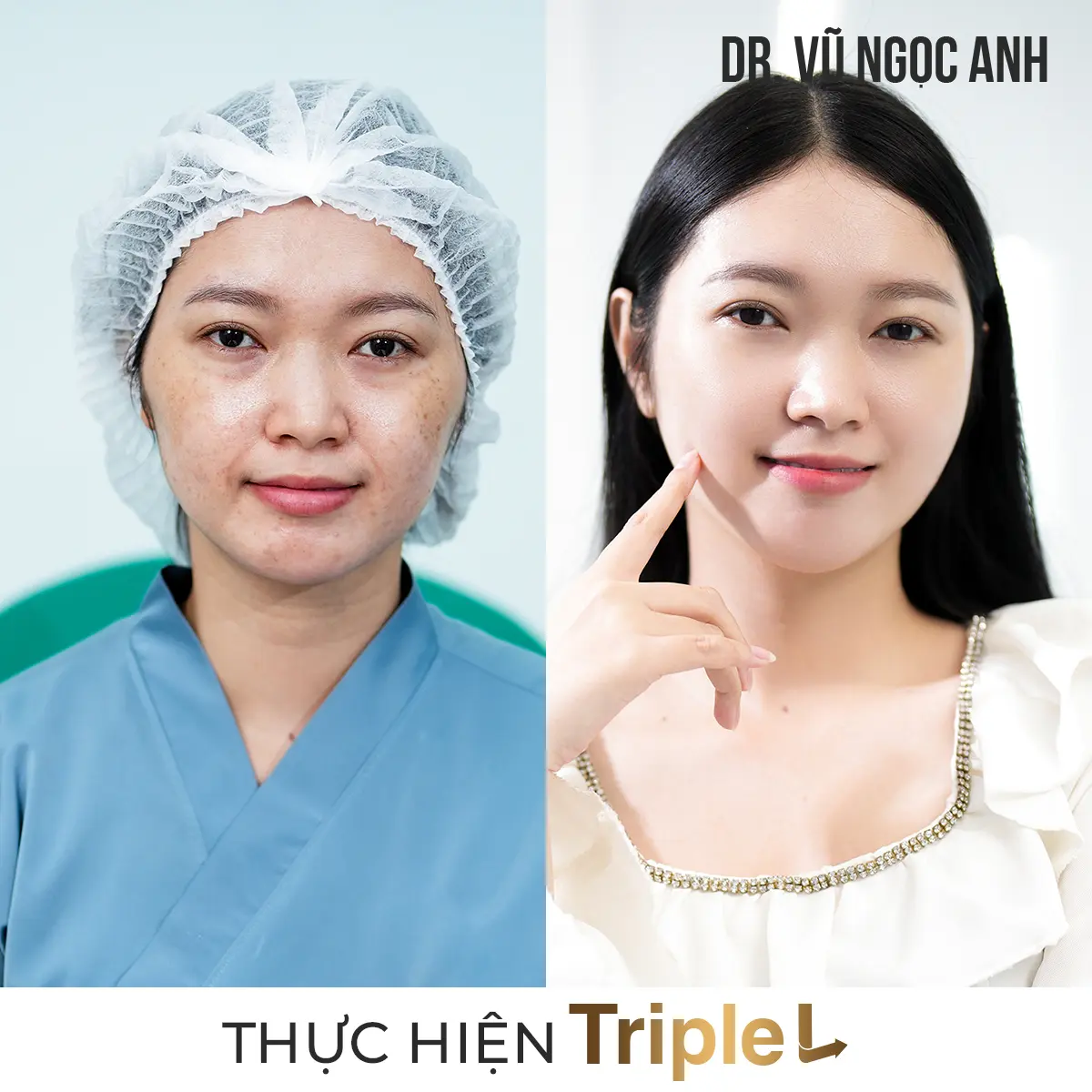 Dịch vụ 9 khách hàng sau khi thực hiện liệu trình Căng bóng da Triple L 1