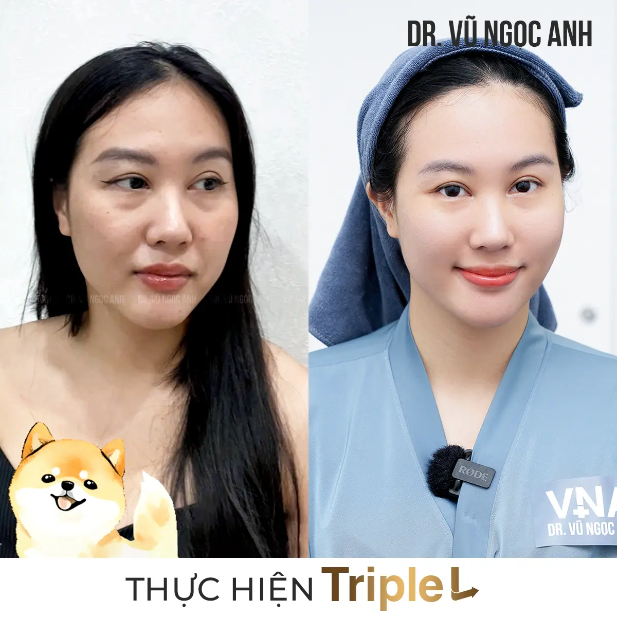 Dịch vụ 7 khách hàng sau khi thực hiện liệu trình Căng bóng da Triple L 2