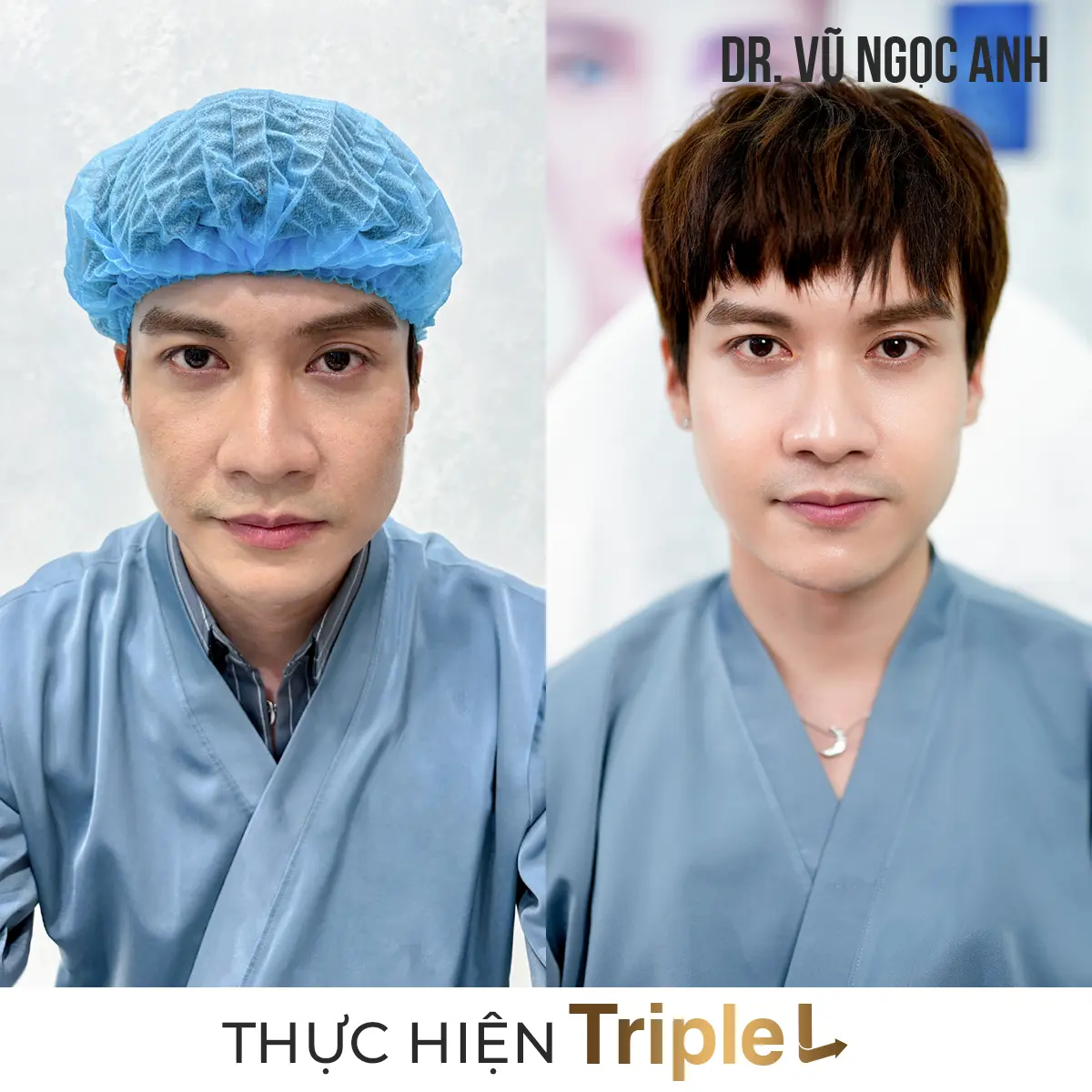 Dịch vụ 6 khách hàng sau khi thực hiện liệu trình Căng bóng da Triple L 3