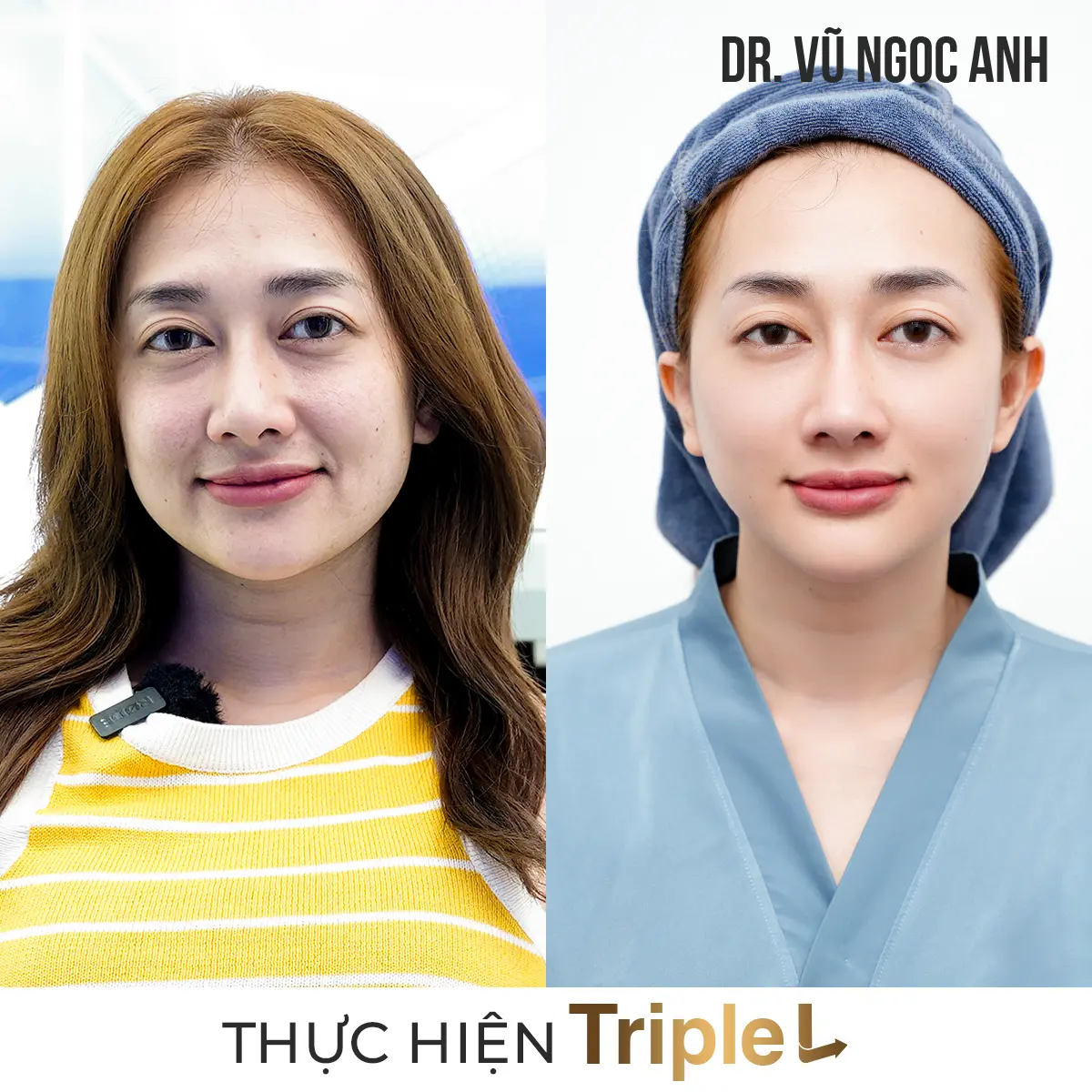 Dịch vụ 5 khách hàng sau khi thực hiện liệu trình Căng bóng da Triple L 4