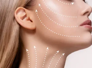 Nâng Cơ Trẻ Hóa Da Ở Đâu Tốt?
