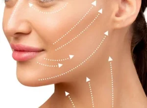 Top 5 Phương Pháp Nâng Cơ Mặt Hiệu Quả