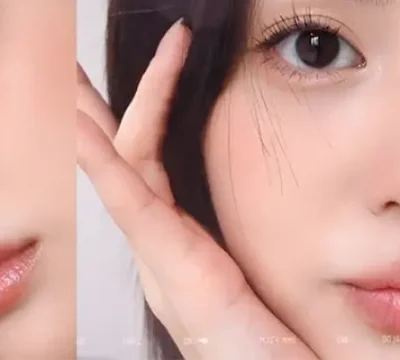 Trẻ hoá da mặt ở đâu tốt
