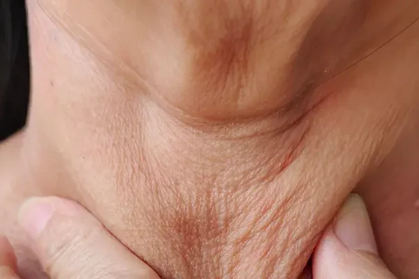 TOP Cách Làm Căng Da Cổ